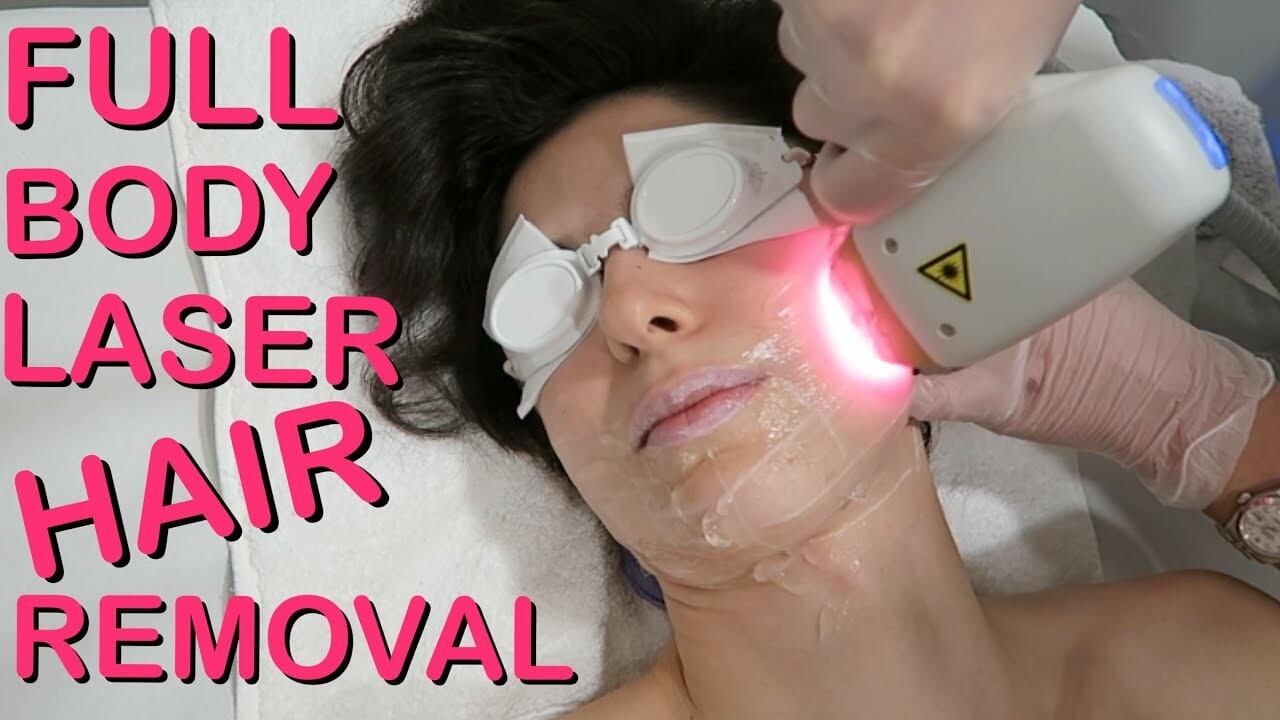 Full body laser hair removal