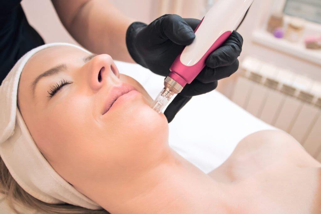 What are the different types of laser treatments for skin 