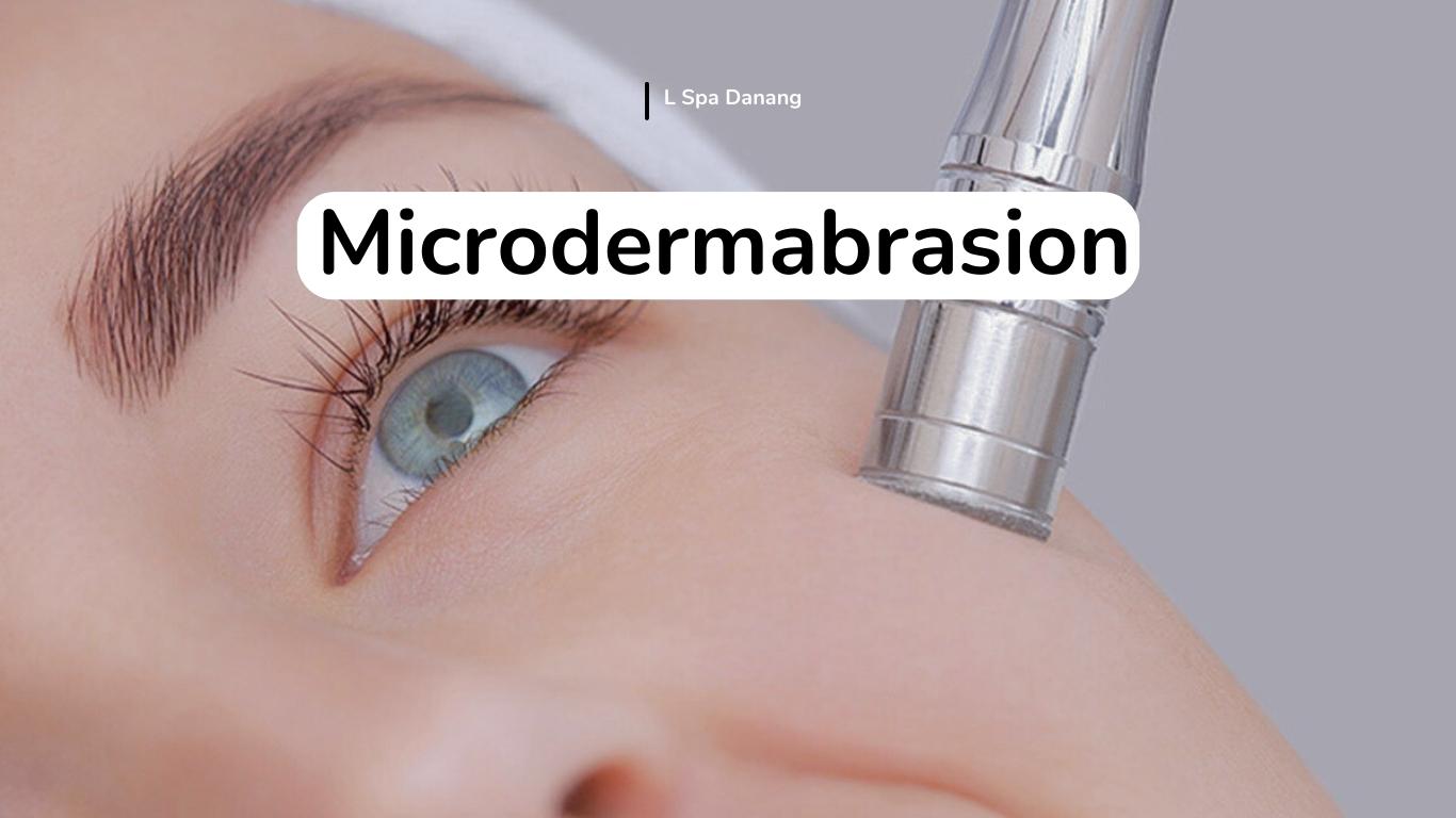 Revealing the Beauty of Your Skin With Microdermabrasion