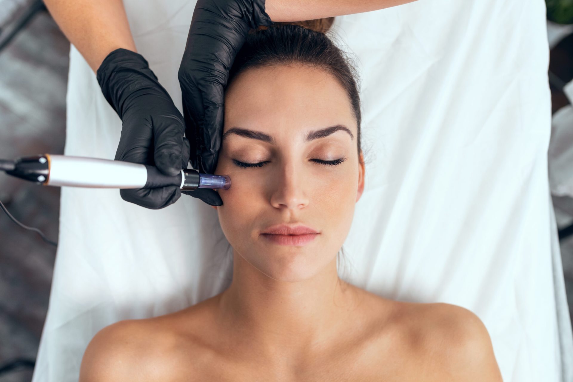 Microneedling - Unlocking the Secrets to Radiant Skin 2 The Benefits of Microneedling