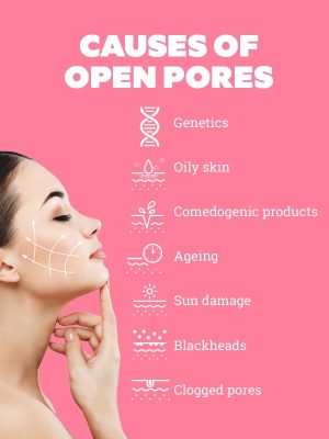 How To Close Open Pores on Face? Facial Treatment for Pores 1 How To Close Open Pores on Face? Facial Treatment for Pores