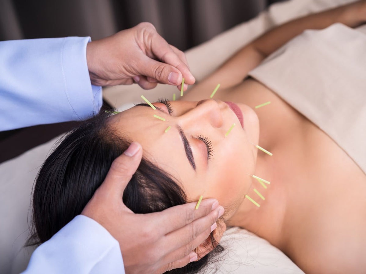 What is Facial Acupuncture?