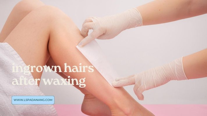 ingrown hairs after waxing L Spa Danang