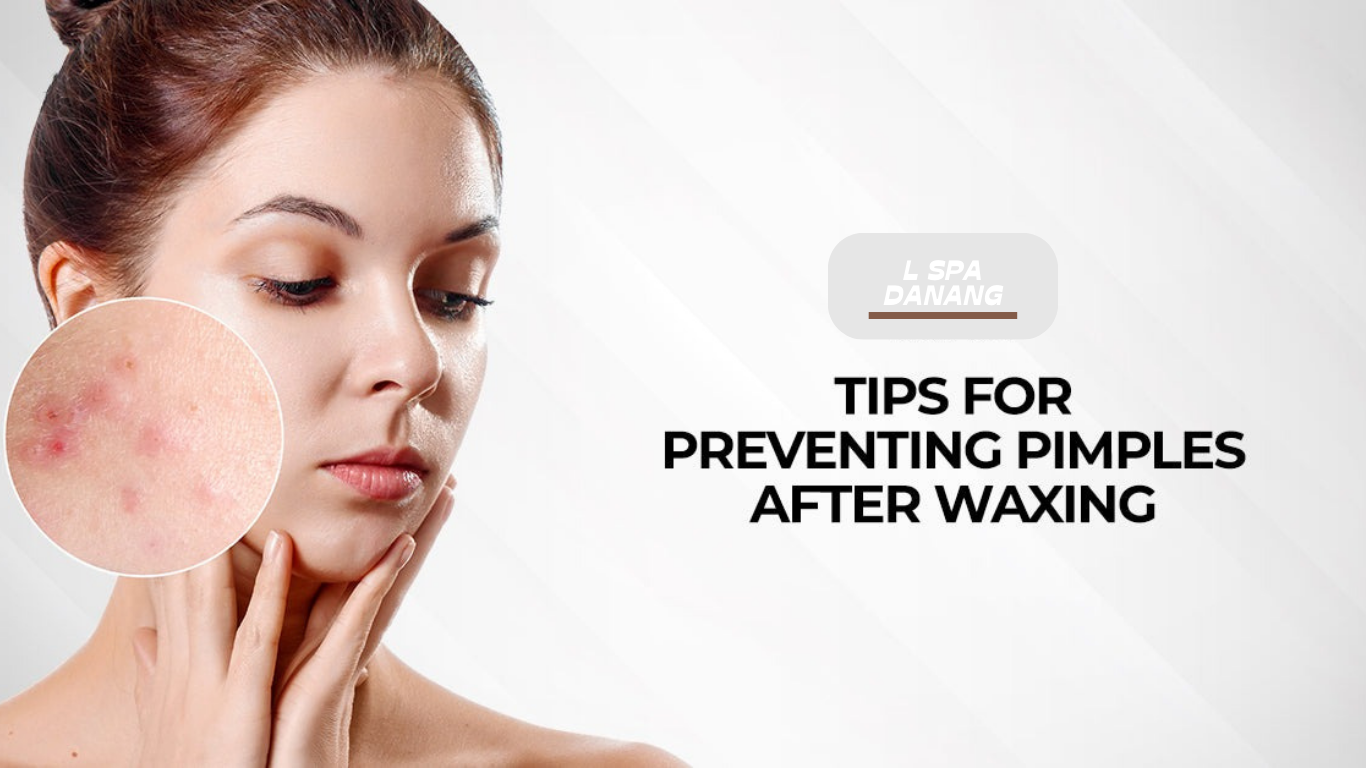 How To Treat And Prevent Pimples After Waxing Safety