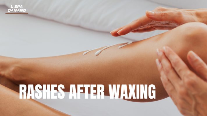 Rashes After Waxing What things do you need to know